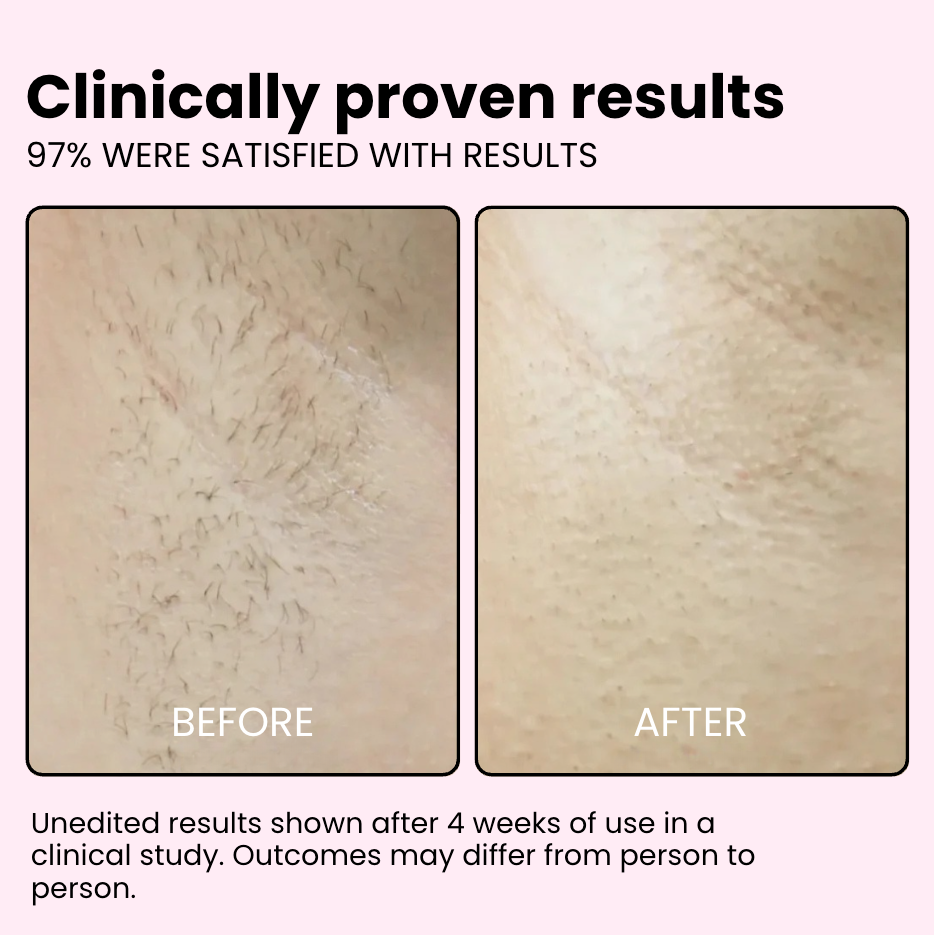 Flair Pro 2.0 IPL Hair Remover