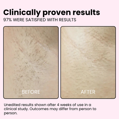 Flair Pro 2.0 IPL Hair Remover